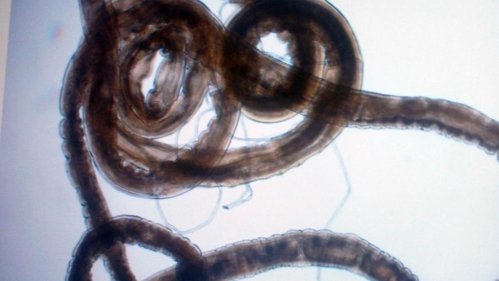 En 150 ans, moins de 60 cas de gongylonémose ont été détectés dans le monde. 