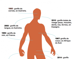 Les greffes, toujours plus loin dans l'expérimentation